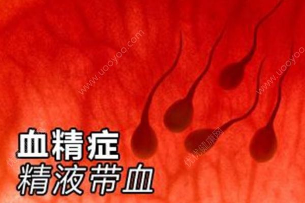 男人得了血精癥怎么辦？推薦四大血精癥的食療方！(1)