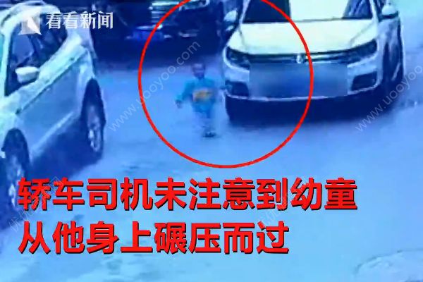 幼童玩躲貓貓慘遭轎車碾壓，危在旦夕，警方已介入(1)