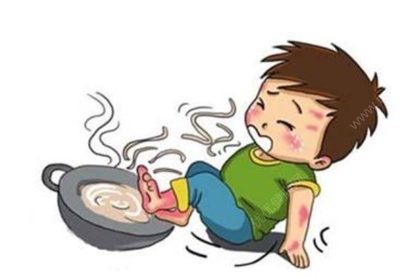 4歲男孩一屁股坐進(jìn)開水桶，全身65%燙傷，燙傷急救處理方法(1)