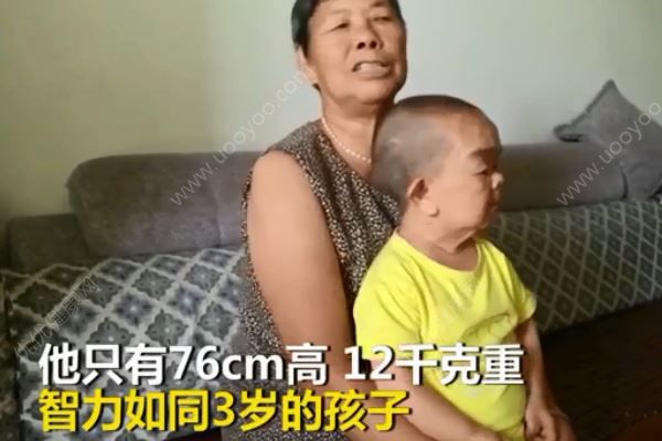 48歲兒子僅76厘米3歲智商永遠(yuǎn)