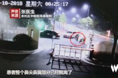 男子圍觀情侶吵架，被咬掉鼻尖，情侶間如何避免吵架？[多圖]