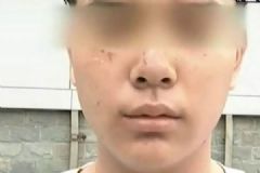 打籃球13歲少年被抓成花臉，如何解決廣場舞擾民問題[多圖]