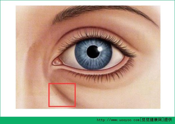 臥蠶和黑眼圈有什么區(qū)別？臥蠶和眼袋有什么區(qū)別？(4)