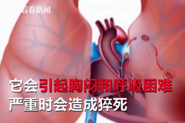 男子打麻將久坐不起險猝死，打麻將猝死是什么原因？(3)