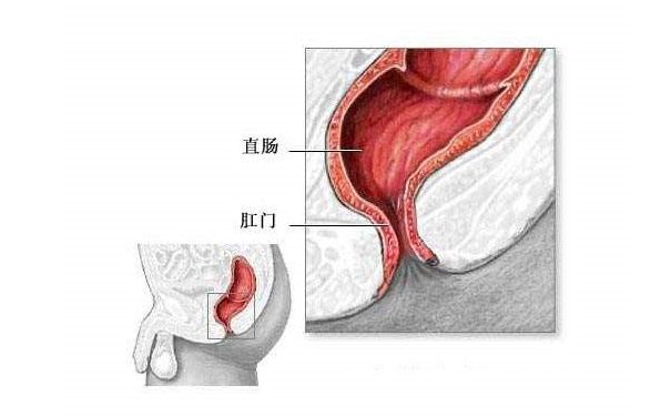 冬天拉屎大便出血怎么回事？冬天便血飲食調(diào)理方法(2)