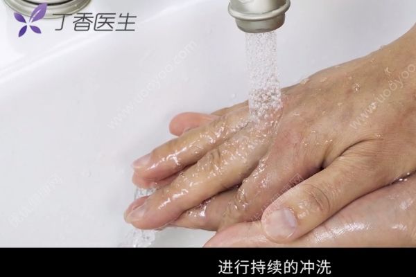 為治感冒給孩子蒸足燙傷，燙傷如何緊急處理？(2)