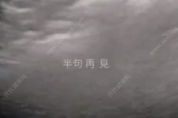 孫燕姿曬二胎寶寶B超視頻做新歌預(yù)告，懷二胎要注意什么？(3)