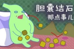 哪些人最容易得膽結(jié)石？膽結(jié)石有哪些明顯特征？[多圖]