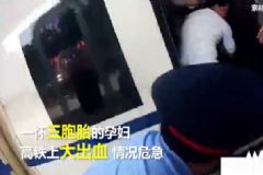 三胞胎孕婦火車上大出血，孕婦大出血該怎么辦？[多圖]