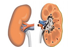 腎炎該怎么治療最好？腎炎有傳染性嗎？[圖]