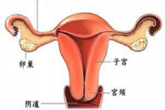 附件炎如何根治？附件炎是怎么引起的？[圖]