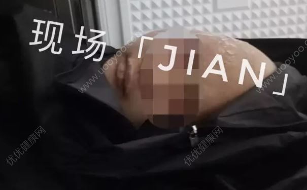 女子遭家暴被虐打致死，面對家暴該怎么辦？(3)