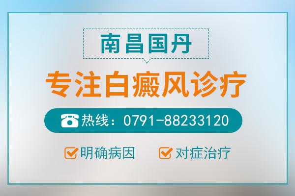 南昌國丹醫(yī)院怎么樣？治療白癜風(fēng)正常大概花多少錢？