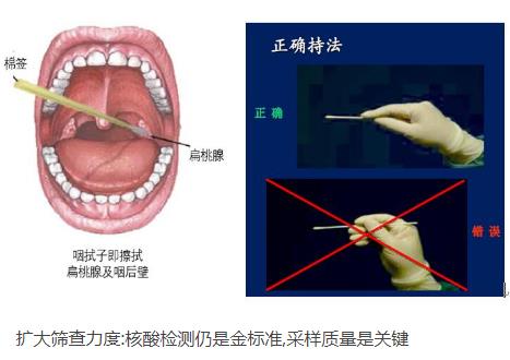 核酸檢測新冠病毒的常用手段：口腔拭子、鼻腔拭子檢測圖解