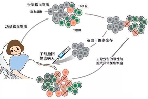 濟南血液病醫(yī)院：治療淋巴瘤自體造血干細(xì)胞移植效果咋樣？