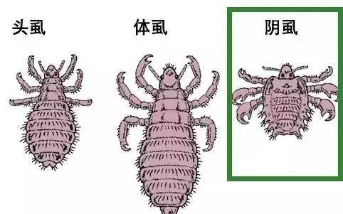 本文目錄 1、長了陰虱怎么辦 2、陰虱的臨床癥狀 3、如何預(yù)防陰虱