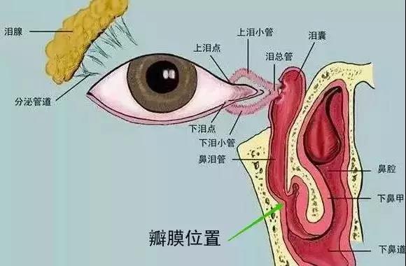 合肥愛(ài)爾眼科醫(yī)院：什么是淚道疾??？