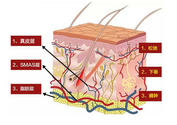 什么是赫本線？聯合麗格向淑英抗衰新理念：45°赫本線緊致術