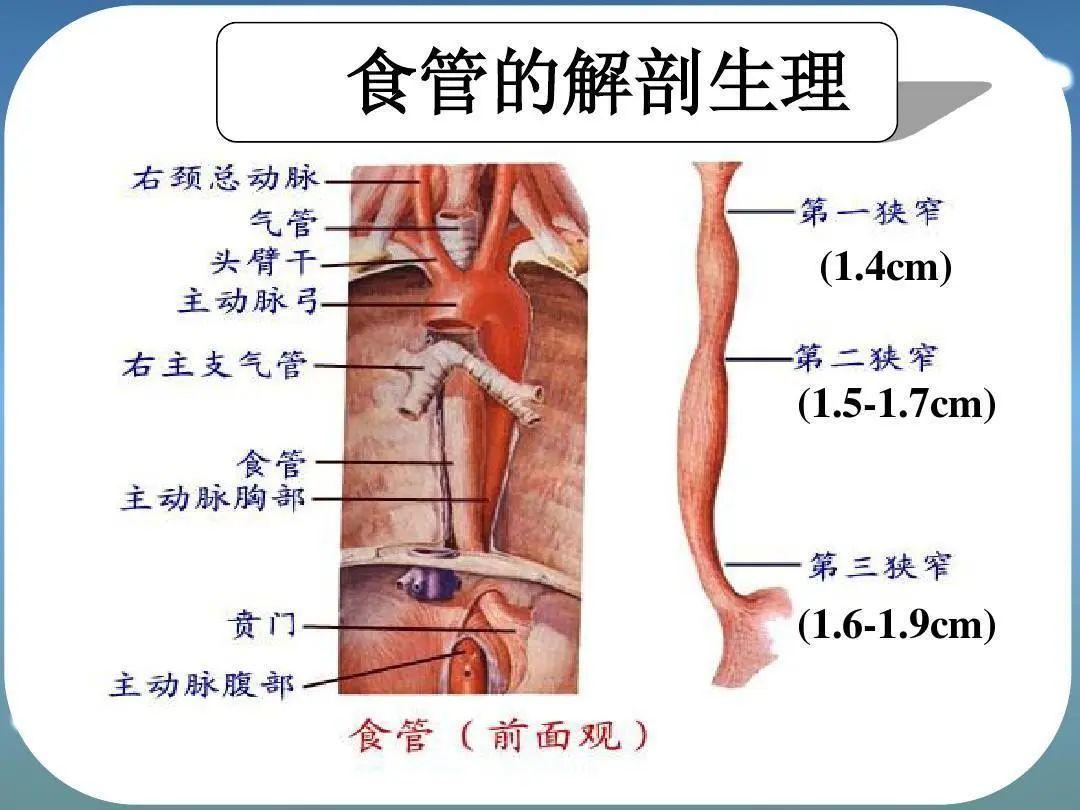 廣州復(fù)大腫瘤醫(yī)院案例998：為食管癌患者打開“生命通道”