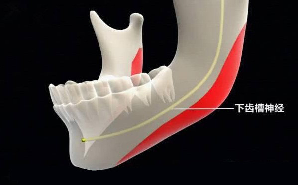 聯(lián)合麗格第一醫(yī)院何照華教授：下頜角手術(shù)會不會損傷神經(jīng)線？
