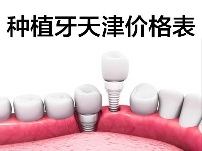 一顆全瓷牙價(jià)格表 天津全瓷種植牙一顆要多少錢?