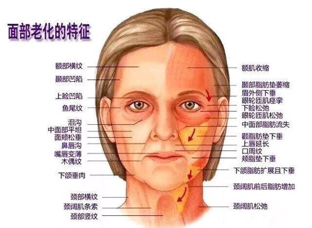  北京煤醫(yī)副主任王馳：TER時(shí)光定格術(shù)為什么聯(lián)合吸脂？