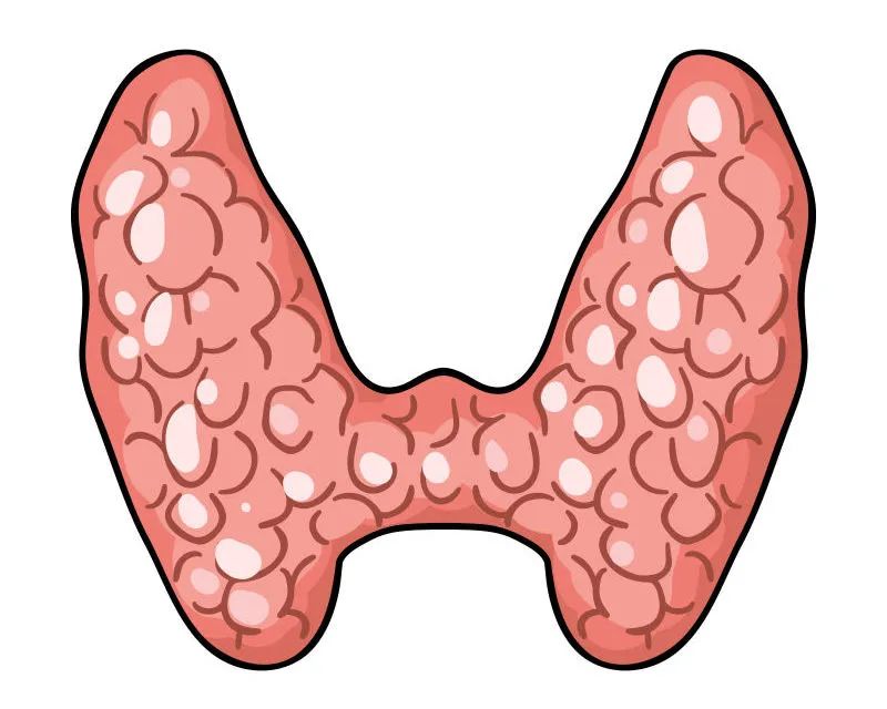 當(dāng)心！成都民生耳鼻喉醫(yī)院：身體有這幾種表現(xiàn)，說明你的甲狀腺出了問題！