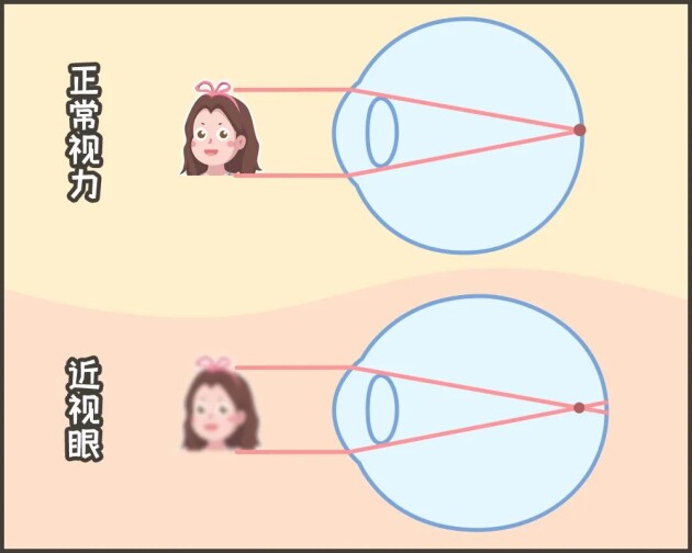 合肥愛爾：「我可以治好你的近視，但不改變度數(shù)?！股?？