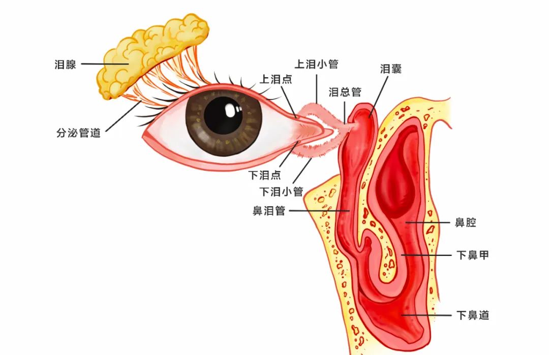 合肥愛爾眼科：女孩流淚8年？！原來是淚道堵塞！