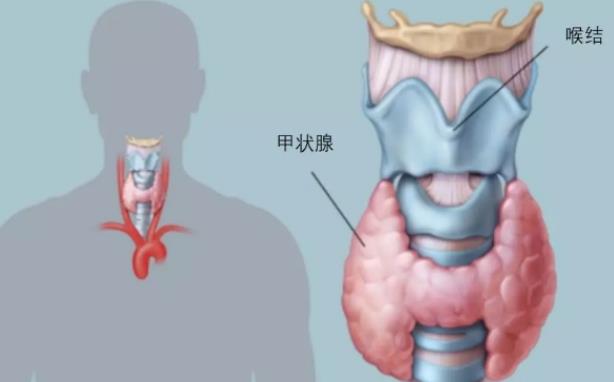 甲狀腺結(jié)節(jié)3類是什么意思 良性惡性腫瘤風(fēng)險(xiǎn)較小