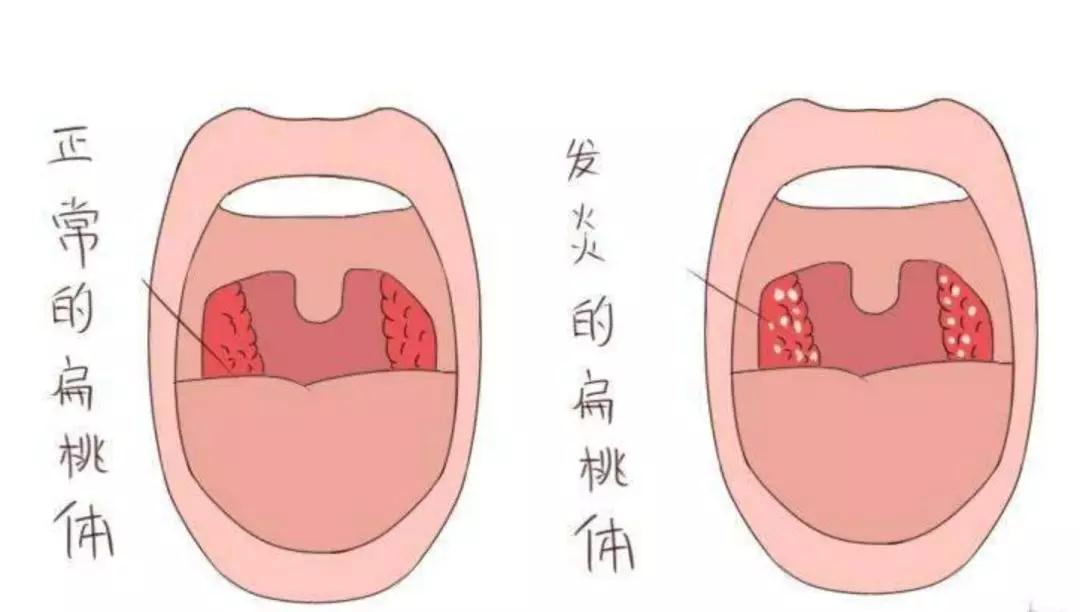 成都民生耳鼻喉醫(yī)院一大波優(yōu)惠活動來襲！耳鼻喉內(nèi)窺鏡檢查免費(fèi)，預(yù)約從速！