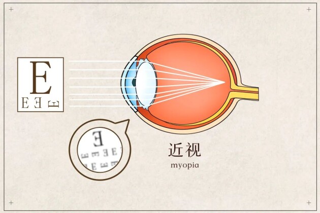 【直播預(yù)告】開學(xué)第一課，名醫(yī)名師教你近視管理和專注力提升，以最佳狀態(tài)為新學(xué)期開篇！