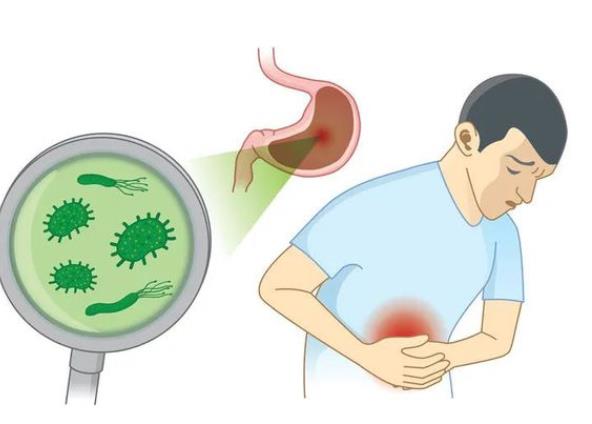 幽門螺桿菌高溫能殺死嗎 幽門螺桿菌能存活多久