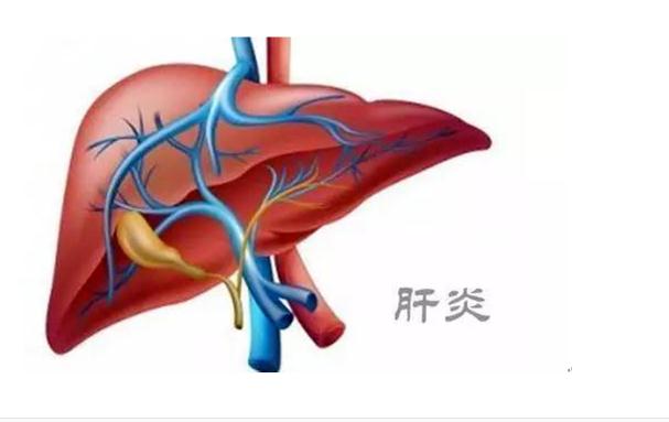 A型肝炎是什么?。緼型肝炎常見知識(shí)？