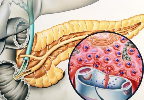 胰腺癌到底有多可怕？ 哪些人容易得胰腺癌？