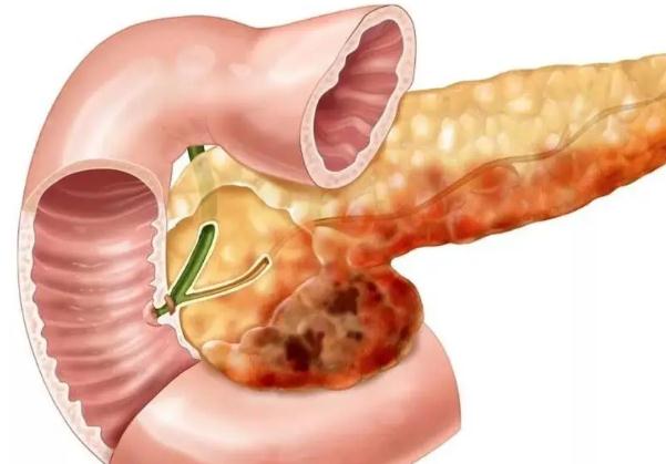 胰腺炎為什么不能喝水？狗狗胰腺炎能治好嗎？