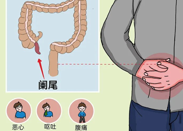 闌尾炎手術要多長時間 闌尾炎手術痛嗎