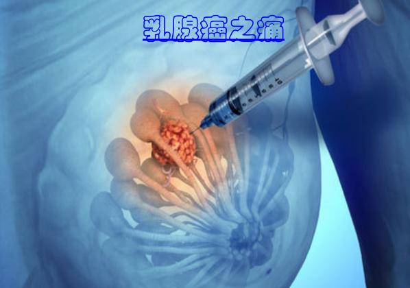 這些食物可以預(yù)防乳腺癌 ？乳腺癌手術(shù)后多久化療？