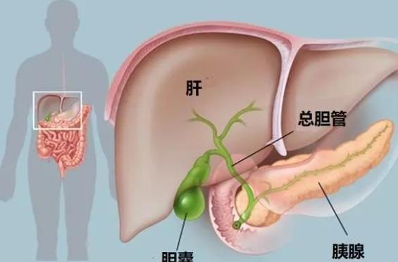 膽結石可以吃蛋白嗎 問膽結石可以吃巧克力嗎