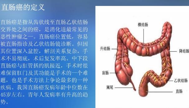 直腸癌微創(chuàng)手術怎么做 直腸癌早期手術有效嗎